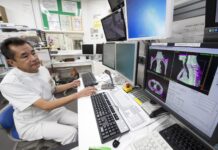 Швеція профінансує підготовку українських медиків із променевої терапії